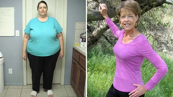 Before and After