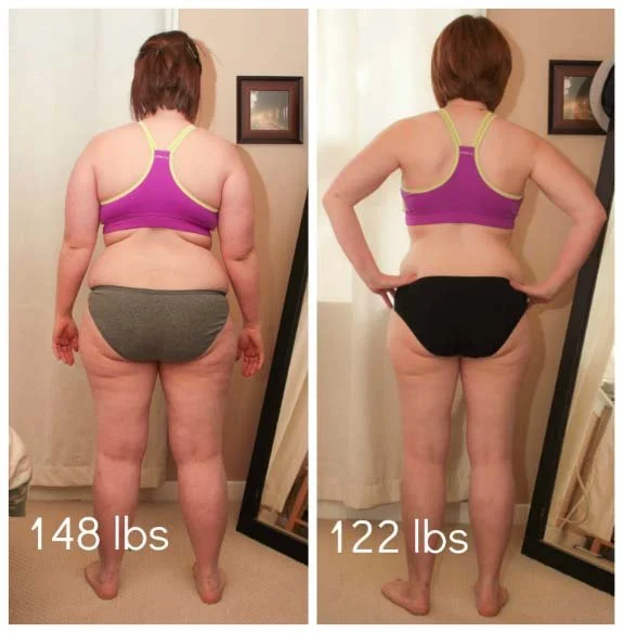 Before and After